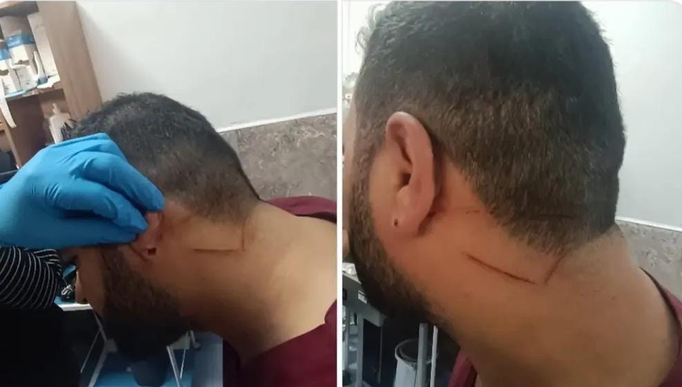 Sağlıkta şiddet bitmiyor: Şanlıurfa'da sağlık çalışanına saldırı!